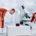 New Non-Invasive Endometriosis Test at Ovagenesis