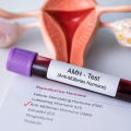 AMH bassa: cosa significa davvero per la fertilità?